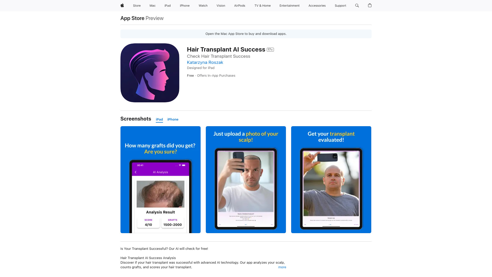 Hair Transplant AI Success